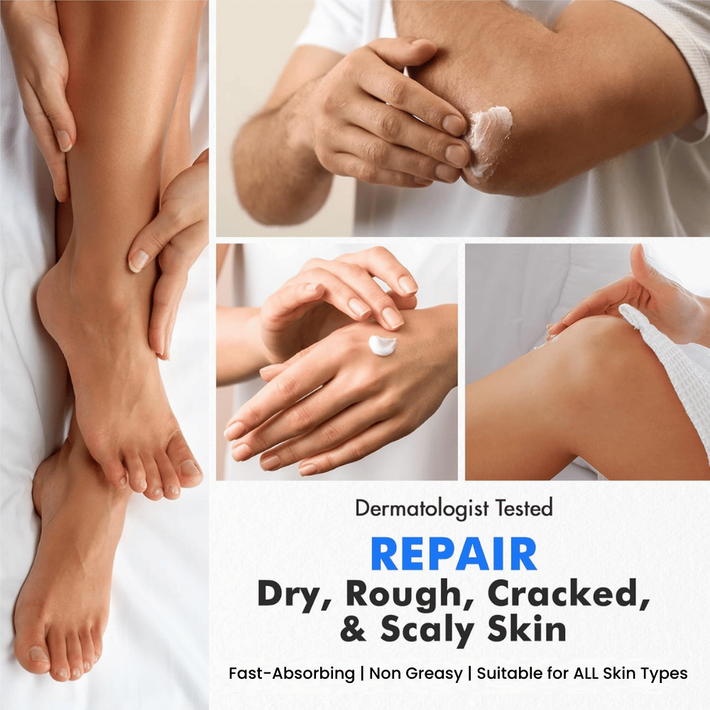 Collage of hands and feet applying urea cream with text promoting dermatologist-tested repair for dry, rough, cracked, and scaly skin.