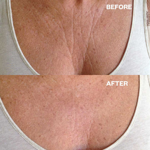 Anti-Wrinkle Neck & Chest Patch