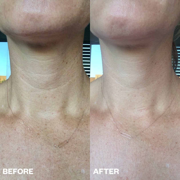Anti-Wrinkle Neck & Chest Patch