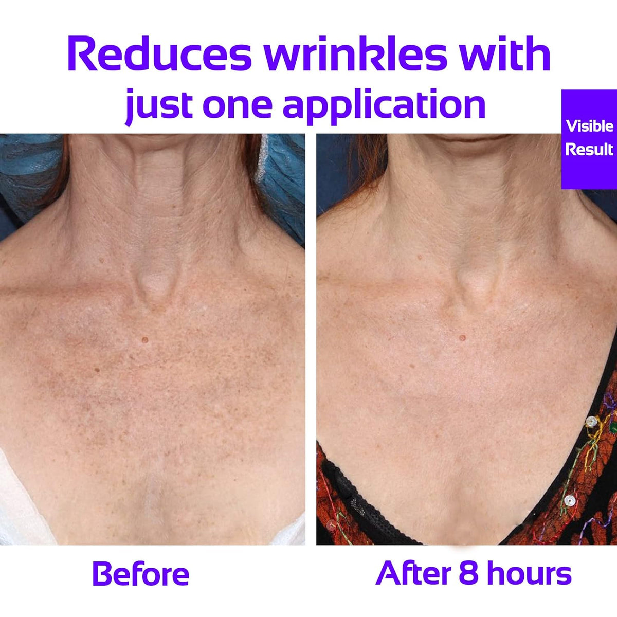Anti-Wrinkle Neck & Chest Patch