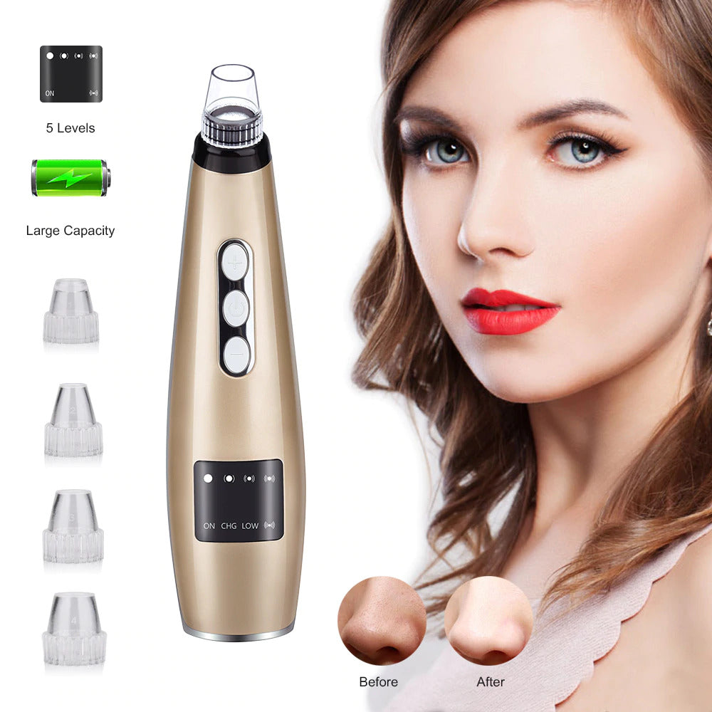 Vacuum Blackhead Remover