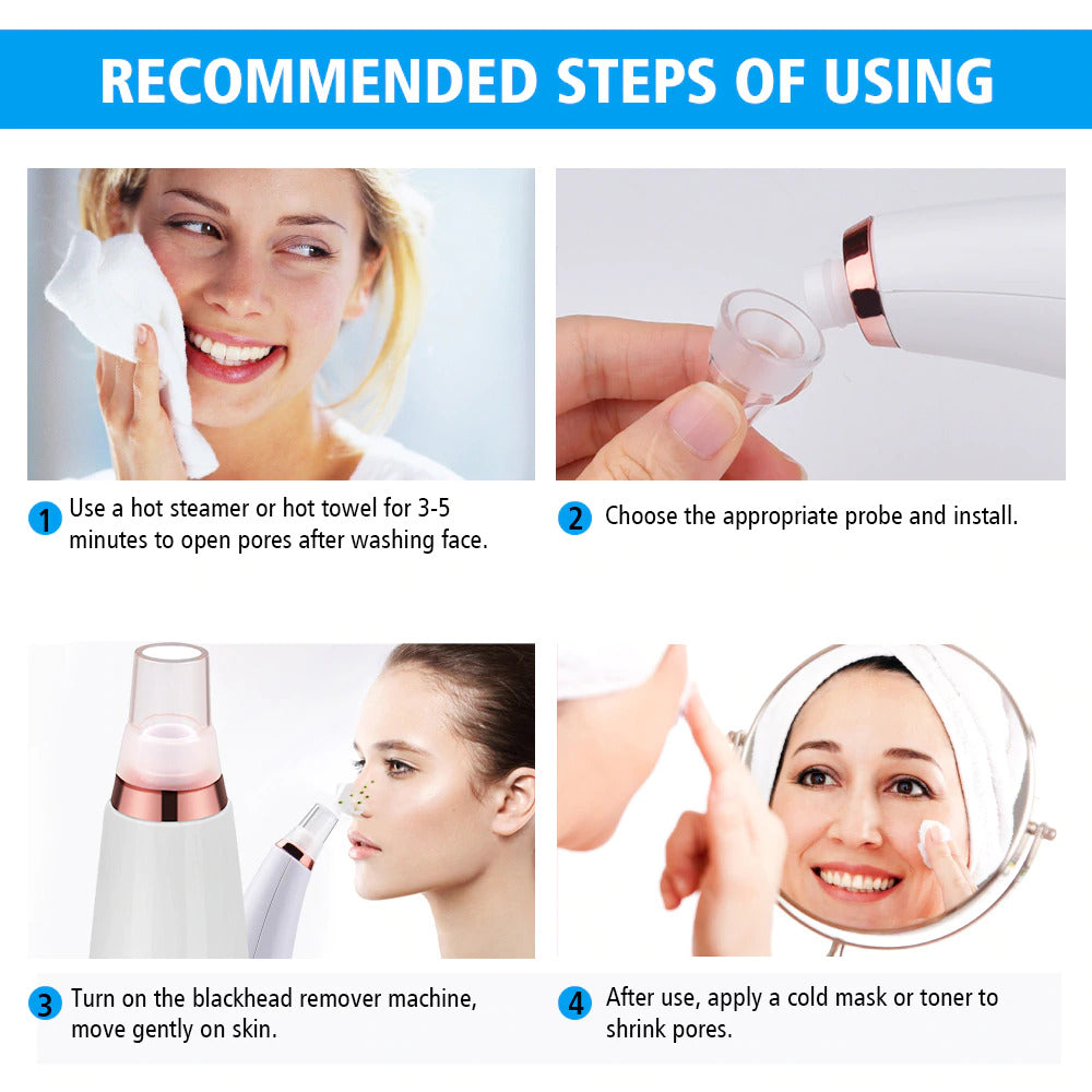 Vacuum Blackhead Remover