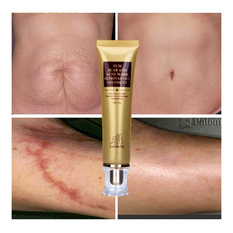 Stretch Mark Removal Cream